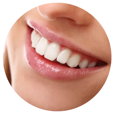 1711676112sec3-pic2 Smiling patient showing white teeth after professional whitening session in Cheras