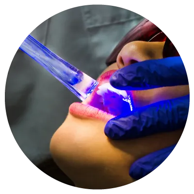 laser treatment Advanced dental laser device used for treat gum disease with minimal discomfort and painless treatments in Cheras dental clinic