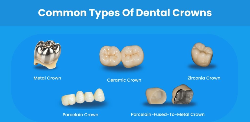 common-types-of-dental-crowns Different types of dental crowns - porcelain, ceramic, PFM, zirconia