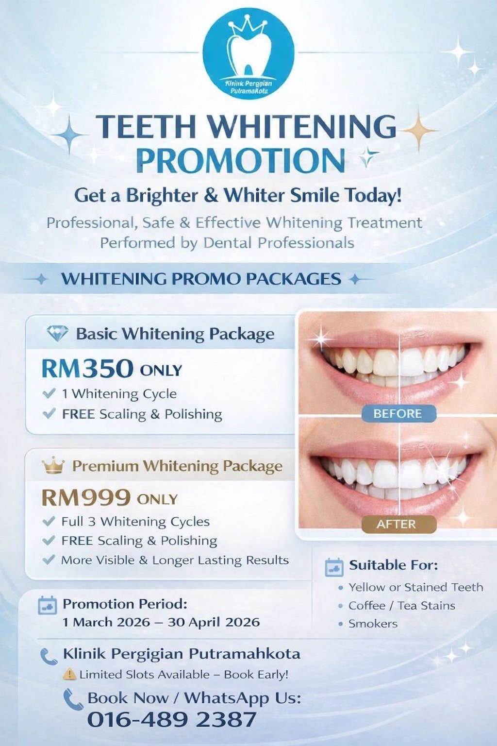 Professional teeth whitening promotion at Putramahkota Dental Clinic showing before and after results - basic whitening RM350, premium whitening RM999 with free scaling and polishing